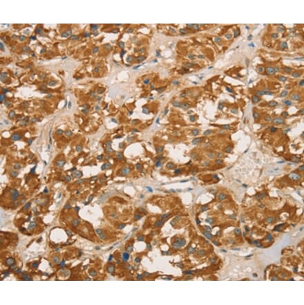 Immunohistochemistry - RBBP8 Antibody from Signalway Antibody (36376) - Antibodies.com