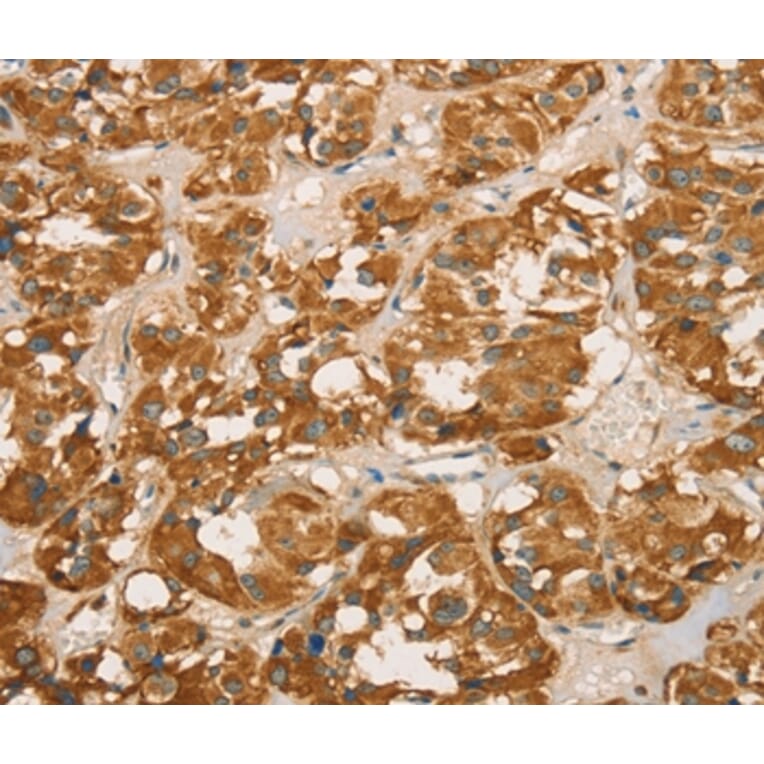 Immunohistochemistry - RBBP8 Antibody from Signalway Antibody (36376) - Antibodies.com