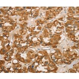 Immunohistochemistry - RBBP8 Antibody from Signalway Antibody (36376) - Antibodies.com