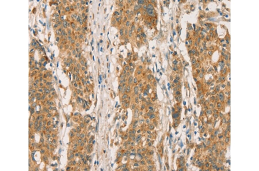 Immunohistochemistry - RBBP8 Antibody from Signalway Antibody (36376) - Antibodies.com