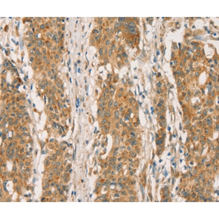 Immunohistochemistry - RBBP8 Antibody from Signalway Antibody (36376) - Antibodies.com