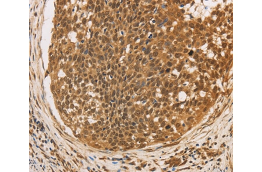 Immunohistochemistry - CXXC5 Antibody from Signalway Antibody (36381) - Antibodies.com