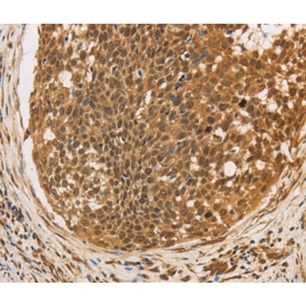 Immunohistochemistry - CXXC5 Antibody from Signalway Antibody (36381) - Antibodies.com