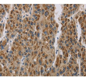 Immunohistochemistry - LOXL4 Antibody from Signalway Antibody (36389) - Antibodies.com