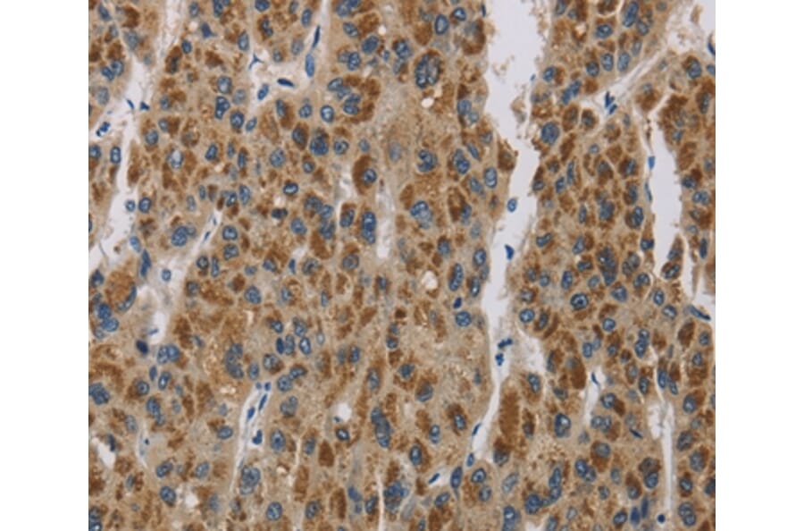 Immunohistochemistry - LOXL4 Antibody from Signalway Antibody (36389) - Antibodies.com