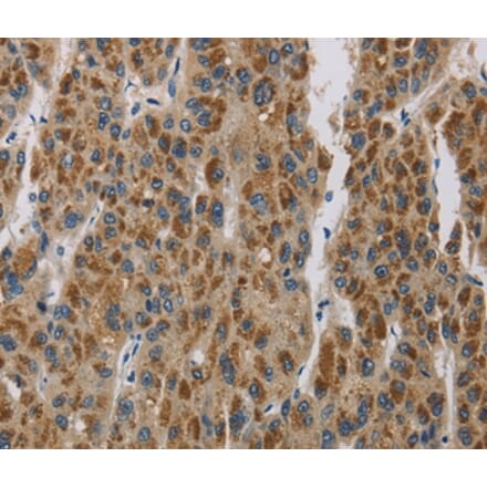 Immunohistochemistry - LOXL4 Antibody from Signalway Antibody (36389) - Antibodies.com