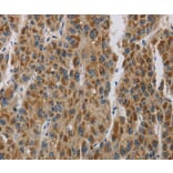 Immunohistochemistry - LOXL4 Antibody from Signalway Antibody (36389) - Antibodies.com