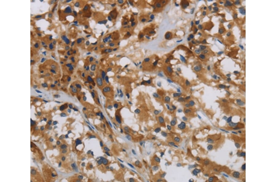 Immunohistochemistry - LOXL4 Antibody from Signalway Antibody (36389) - Antibodies.com