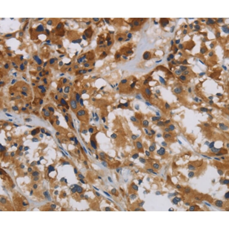 Immunohistochemistry - LOXL4 Antibody from Signalway Antibody (36389) - Antibodies.com