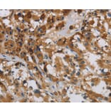 Immunohistochemistry - LOXL4 Antibody from Signalway Antibody (36389) - Antibodies.com
