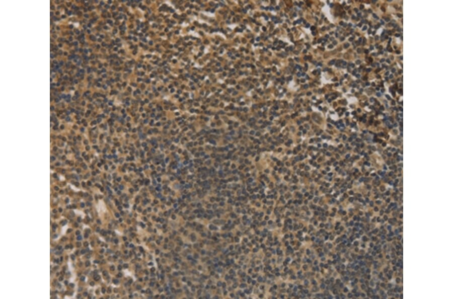 Immunohistochemistry - DACH1 Antibody from Signalway Antibody (36396) - Antibodies.com