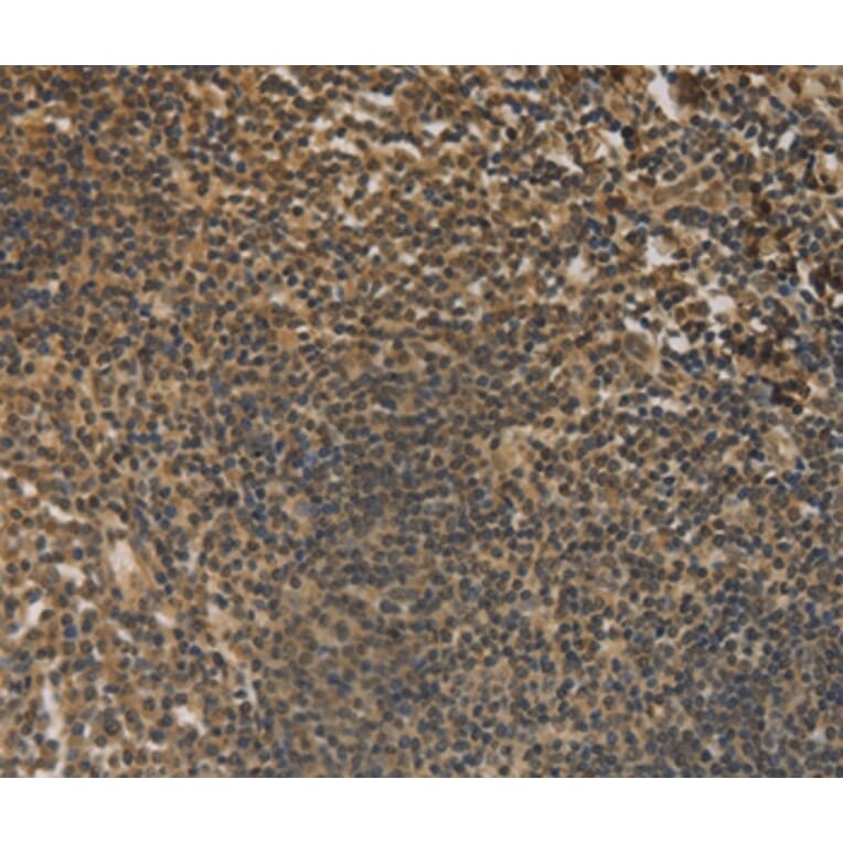 Immunohistochemistry - DACH1 Antibody from Signalway Antibody (36396) - Antibodies.com