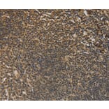 Immunohistochemistry - DACH1 Antibody from Signalway Antibody (36396) - Antibodies.com