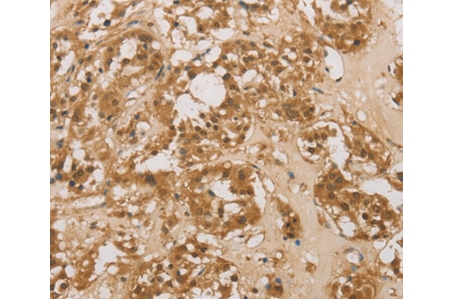 Immunohistochemistry - DACH1 Antibody from Signalway Antibody (36396) - Antibodies.com