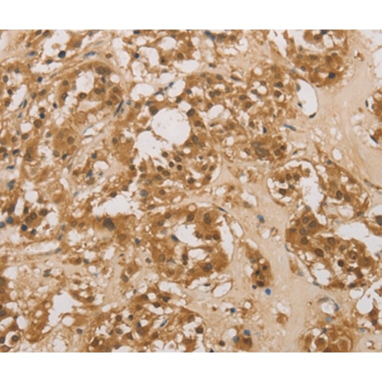 Immunohistochemistry - DACH1 Antibody from Signalway Antibody (36396) - Antibodies.com