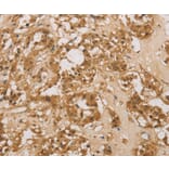 Immunohistochemistry - DACH1 Antibody from Signalway Antibody (36396) - Antibodies.com