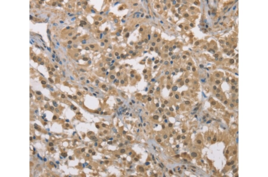 Immunohistochemistry - DACH2 Antibody from Signalway Antibody (36397) - Antibodies.com