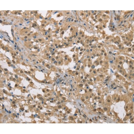 Immunohistochemistry - DACH2 Antibody from Signalway Antibody (36397) - Antibodies.com