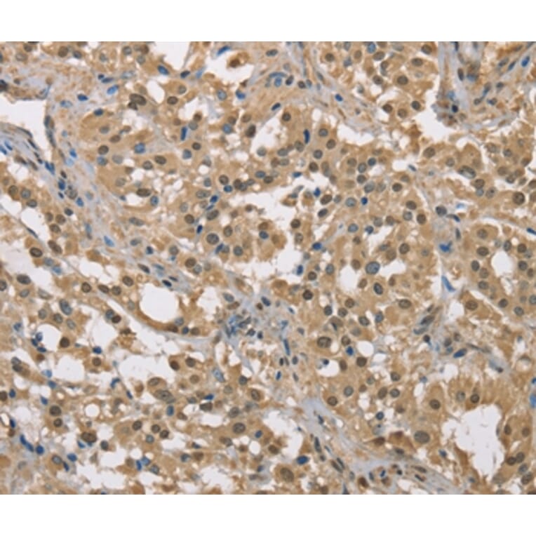 Immunohistochemistry - DACH2 Antibody from Signalway Antibody (36397) - Antibodies.com