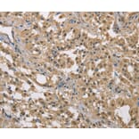 Immunohistochemistry - DACH2 Antibody from Signalway Antibody (36397) - Antibodies.com