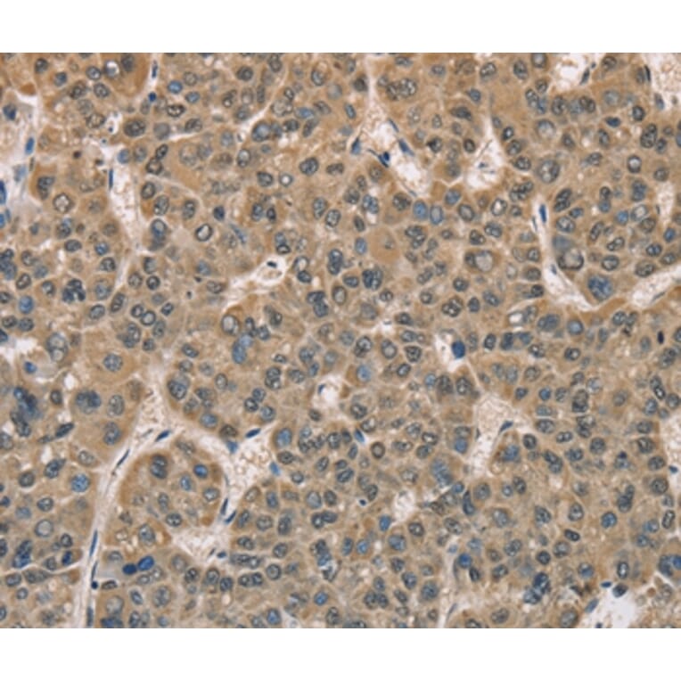 Immunohistochemistry - DACH2 Antibody from Signalway Antibody (36397) - Antibodies.com