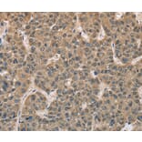 Immunohistochemistry - DACH2 Antibody from Signalway Antibody (36397) - Antibodies.com