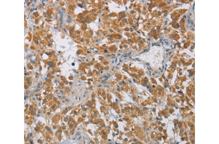 Immunohistochemistry - DIDO1 Antibody from Signalway Antibody (36399) - Antibodies.com