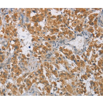 Immunohistochemistry - DIDO1 Antibody from Signalway Antibody (36399) - Antibodies.com