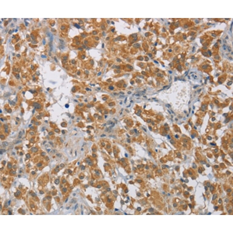 Immunohistochemistry - DIDO1 Antibody from Signalway Antibody (36399) - Antibodies.com