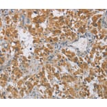 Immunohistochemistry - DIDO1 Antibody from Signalway Antibody (36399) - Antibodies.com