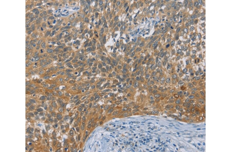 Immunohistochemistry - DIDO1 Antibody from Signalway Antibody (36399) - Antibodies.com