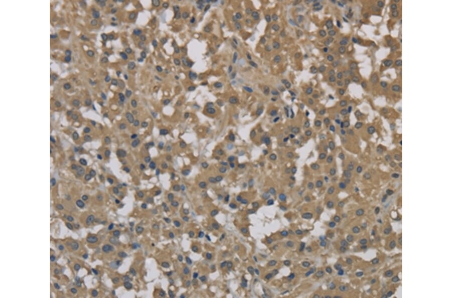 Immunohistochemistry - DCTN3 Antibody from Signalway Antibody (36403) - Antibodies.com