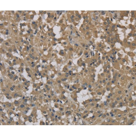 Immunohistochemistry - DCTN3 Antibody from Signalway Antibody (36403) - Antibodies.com