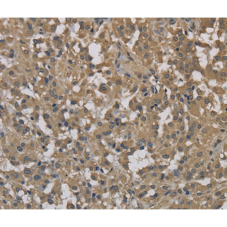 Immunohistochemistry - DCTN3 Antibody from Signalway Antibody (36403) - Antibodies.com