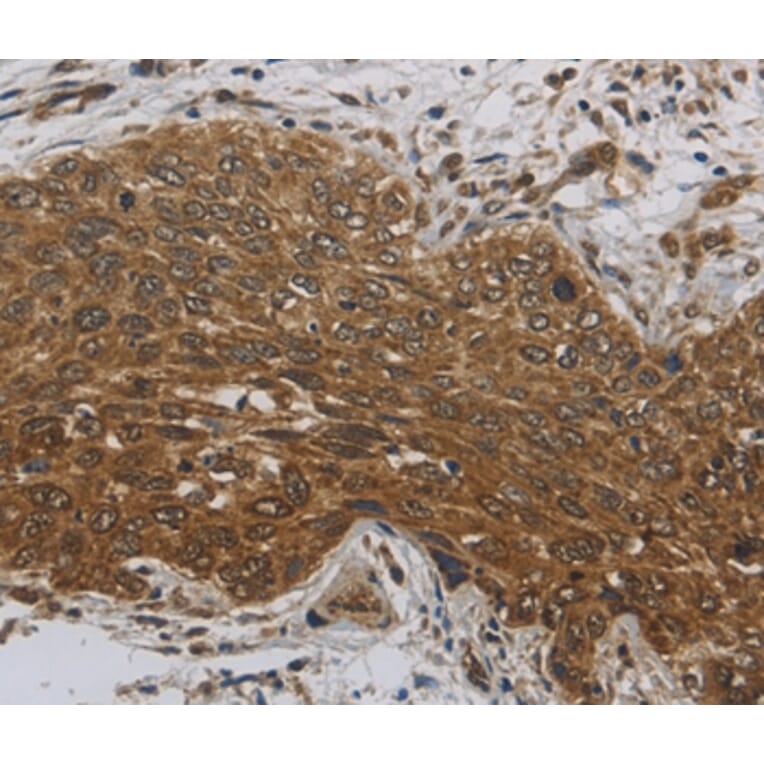 Immunohistochemistry - DCTN3 Antibody from Signalway Antibody (36403) - Antibodies.com