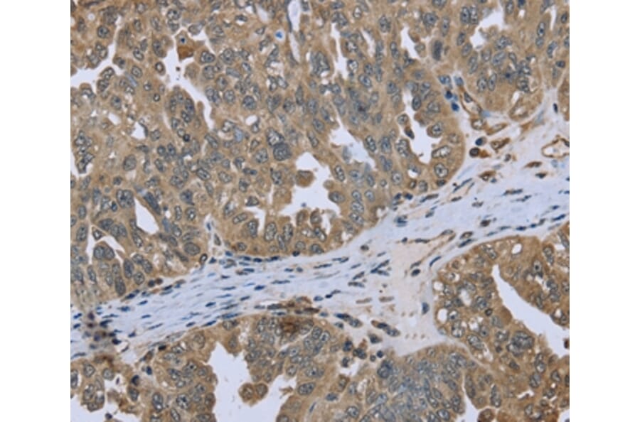 Immunohistochemistry - DCTN4 Antibody from Signalway Antibody (36404) - Antibodies.com