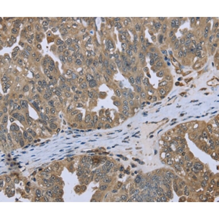 Immunohistochemistry - DCTN4 Antibody from Signalway Antibody (36404) - Antibodies.com