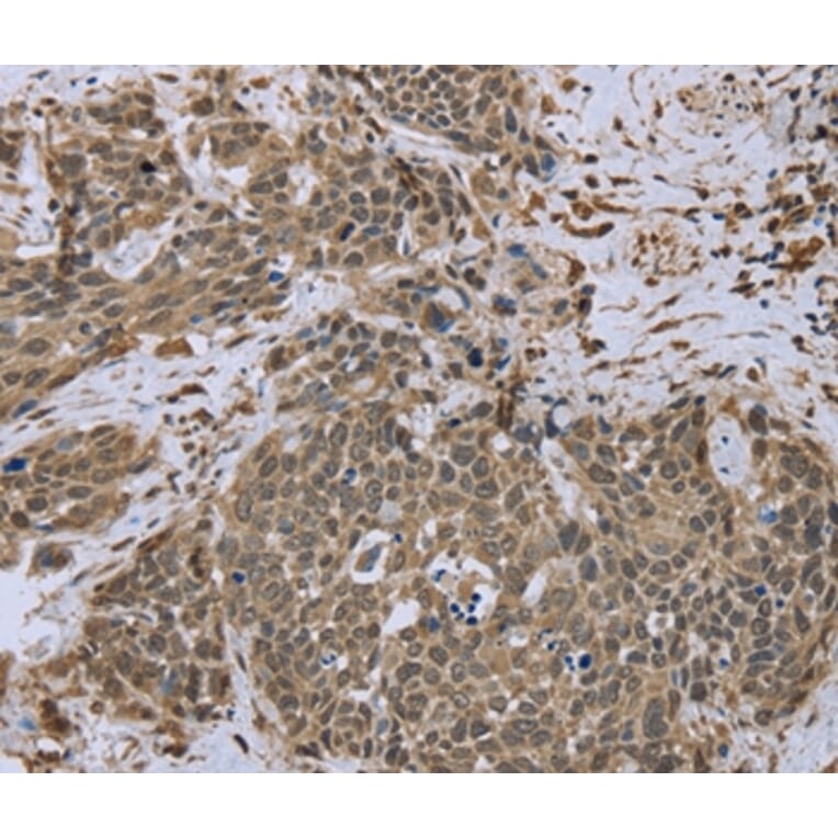 Immunohistochemistry - DCTN4 Antibody from Signalway Antibody (36404) - Antibodies.com