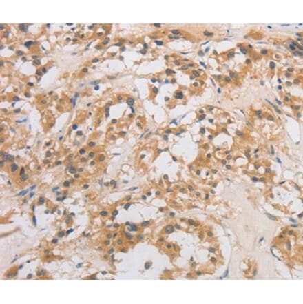 Immunohistochemistry - DCTN5 Antibody from Signalway Antibody (36405) - Antibodies.com