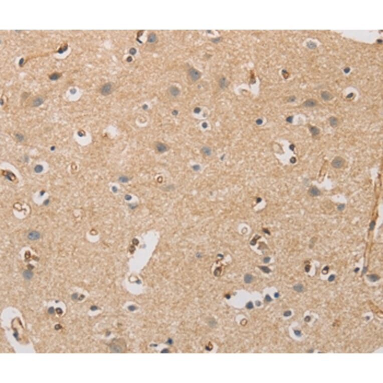 Immunohistochemistry - DCTN5 Antibody from Signalway Antibody (36405) - Antibodies.com