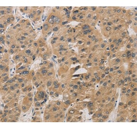 Immunohistochemistry - DDIT4 Antibody from Signalway Antibody (36407) - Antibodies.com