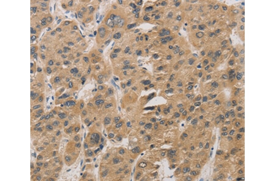 Immunohistochemistry - DDIT4 Antibody from Signalway Antibody (36407) - Antibodies.com