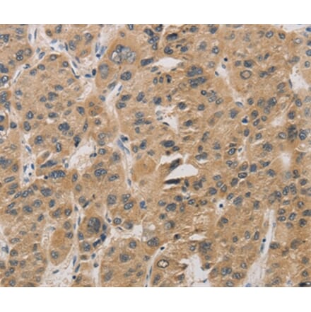 Immunohistochemistry - DDIT4 Antibody from Signalway Antibody (36407) - Antibodies.com