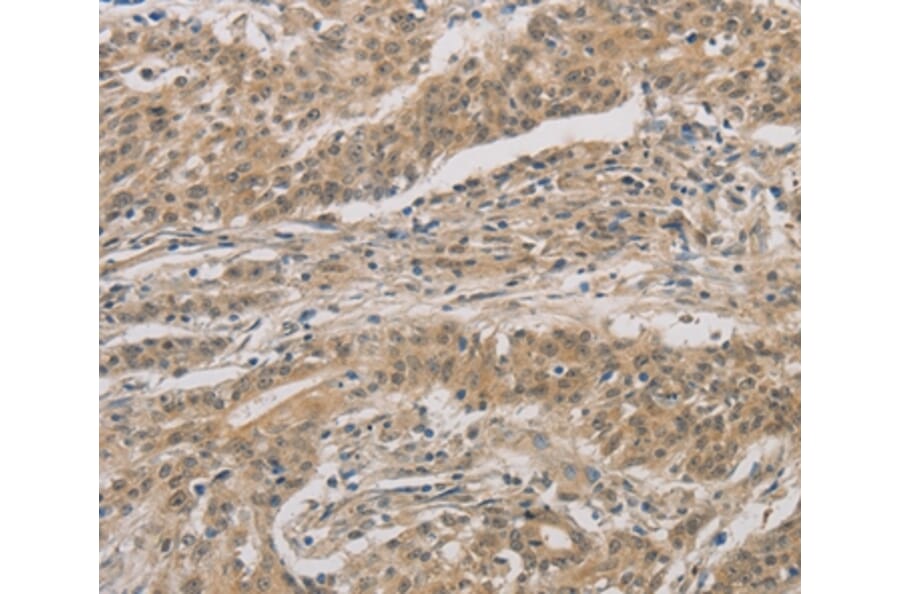 Immunohistochemistry - DDIT4 Antibody from Signalway Antibody (36407) - Antibodies.com