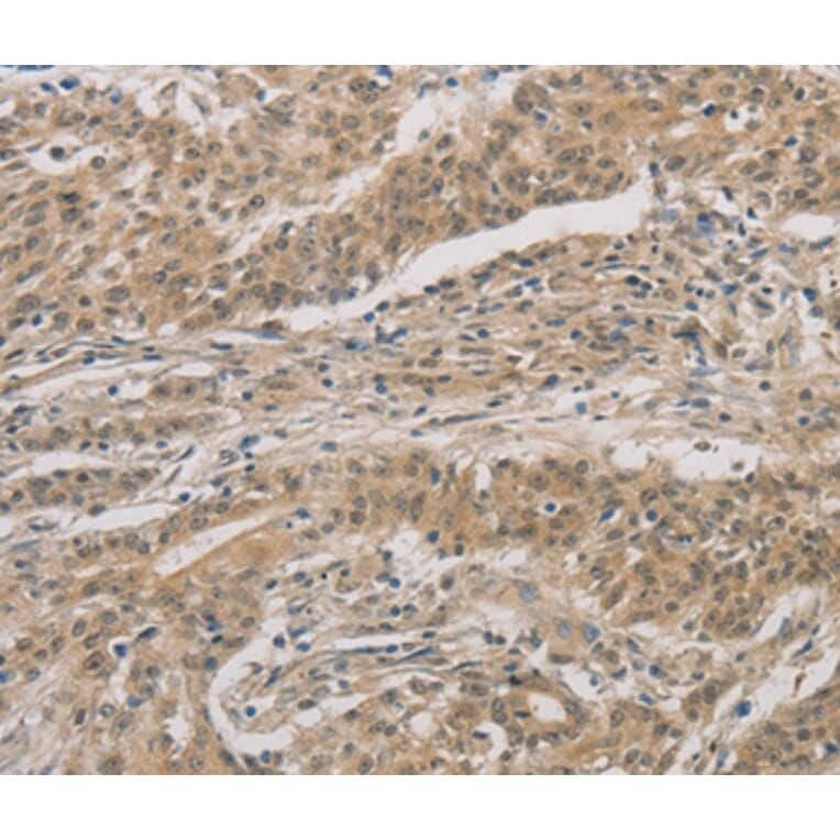 Immunohistochemistry - DDIT4 Antibody from Signalway Antibody (36407) - Antibodies.com