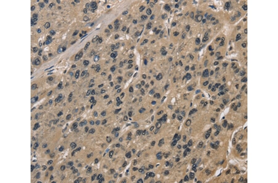 Immunohistochemistry - CCAR1 Antibody from Signalway Antibody (36417) - Antibodies.com