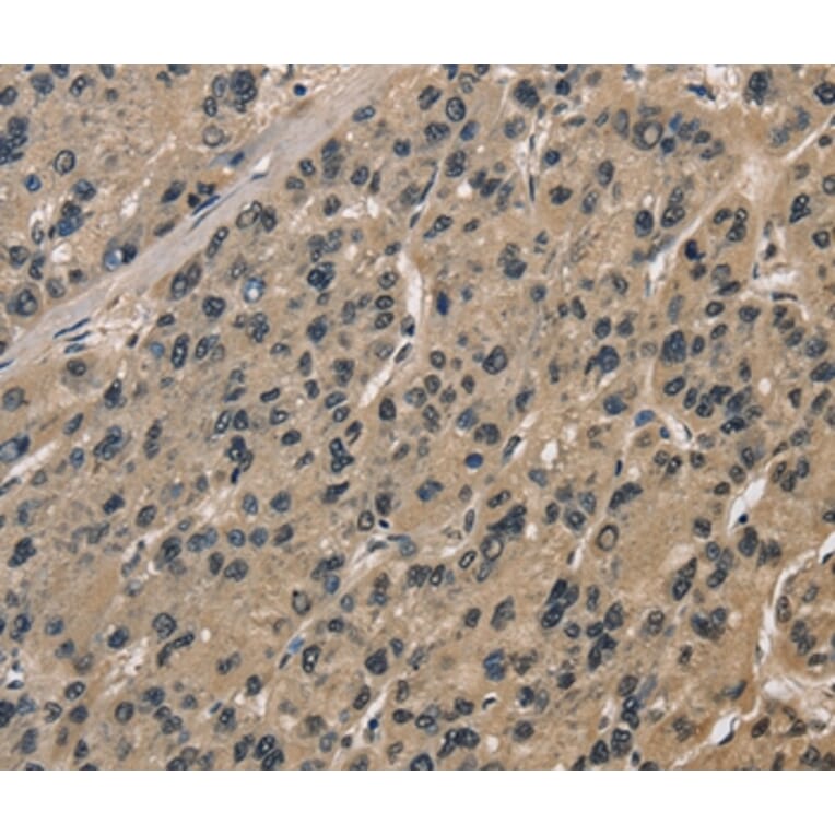 Immunohistochemistry - CCAR1 Antibody from Signalway Antibody (36417) - Antibodies.com
