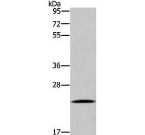 UBE2S Antibody from Signalway Antibody (36429) - Antibodies.com
