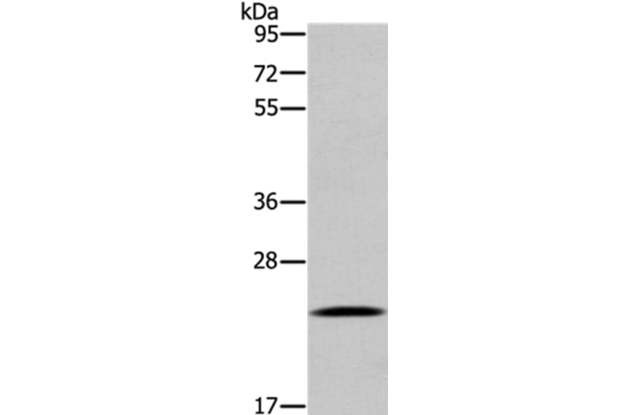 UBE2S Antibody from Signalway Antibody (36429) - Antibodies.com
