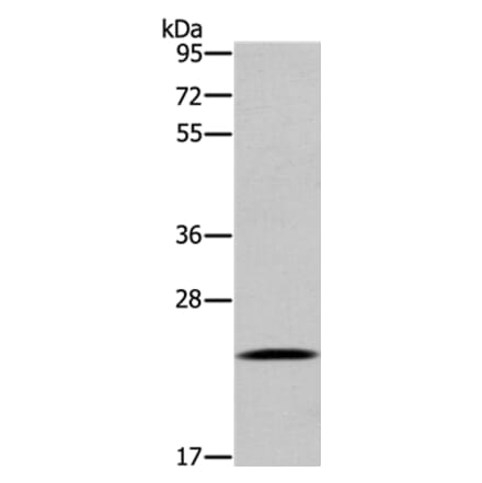 UBE2S Antibody from Signalway Antibody (36429) - Antibodies.com